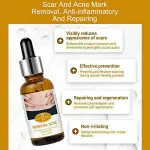 Aichun Beauty Remove Scars Serum