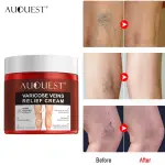 Aqouest Varicose Veins Relief Cream