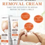Auquest Stretch Marks Cream