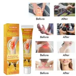 Bee Venom Cream Propolis Joint Pain