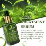Breylee Acne Treatment Serum