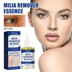 Eelhoe Milia Removal Relieve Serum