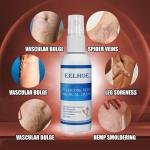 Eelhoe Varicose Veins Spray