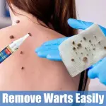 Eelhoe Wart Removing Pen
