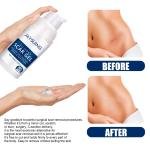 Jaysuing Silicone Scar Gel