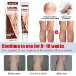 KanyeHB Vein Cream