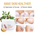 Melao Scar Removal Cream