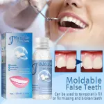 Moldable Resin Tooth Repair Glue