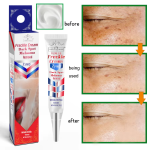 Natureguess Freckle Dark Spot Remover Cream