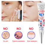 Natureguess Freckle Dark Spot Remover Cream