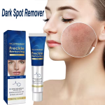 Nicotinamide Freckle Removing Cream