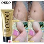 Oedo Rose Remove Stretch Marks Cream