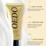 Oedo Rose Remove Stretch Marks Cream