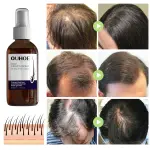Ouhoe Hair Regrowth Spray