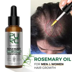 Rosemary Hair Growth Serum – Anti Hair Loss & Baldness Treatment for Men & Women