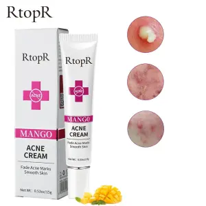 Rtopr Mango Acne Scar Repair Cream