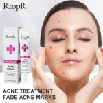 Rtopr Mango Acne Scar Repair Cream