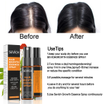 Sevich Hair Growth Essence Spray 30ml – Thicken & Regrow Thin Hair, Anti-Hair Loss Treatment