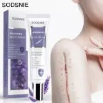 Sodsnie Advanced Scar Cream