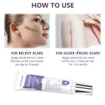 Sodsnie Advanced Scar Cream