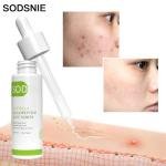 Sodsnie Centella Oligopeptide Acne Serum