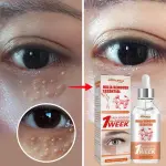 South Moon Milia Removal Essential Serum