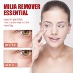 South Moon Milia Removal Essential Serum