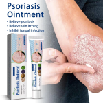 South Moon Psoriasis Treatment Cream