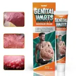 Sumifun Genital Wart Remover Cream