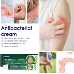 Sumifun Psoriasis Medicine Cream