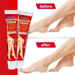 Sumifun Varicose Veins Cream