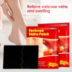 Sumifun Varicose Veins Patch