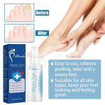 Ximonth Athlete's Foot Relief Spray