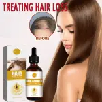 Yifucao Hair Growth Oil