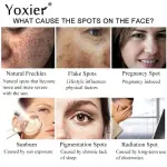 Yoxier Dark Spots Corrector Cream