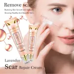 Yoxier Lavender Scar Repair Cream