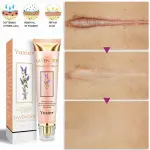 Yoxier Lavender Scar Repair Cream