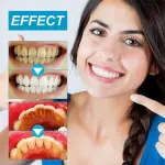 Yoxier Teeth Whitening Powder