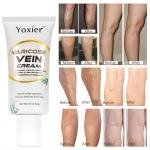 Yoxier Varicose Vein Repair Cream