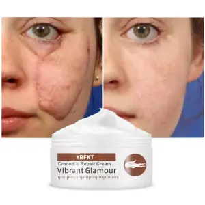 YRFKT Crocodile Repair Scar Acne Cream