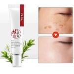 YRFKT Face Brightening Freckles Cream
