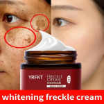 YRFKT Whitening Freckle Cream